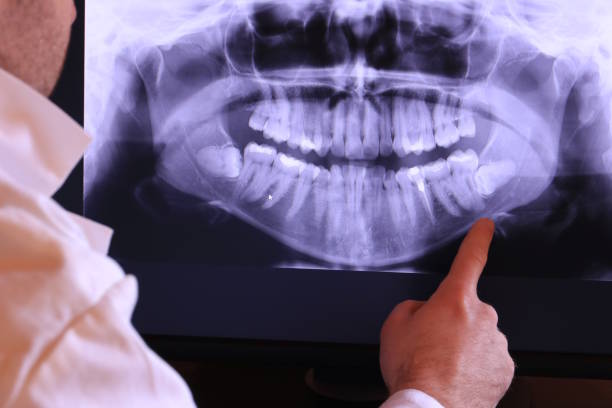 Best Urgent Dental Care for Toothache in Hanscom Af, MA